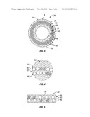 System and Method for Enhancing Packer Operation and Longevity diagram and image