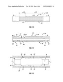 System and Method for Enhancing Packer Operation and Longevity diagram and image