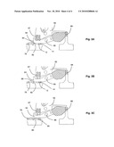 Evaluation of the integrity of depressed contacts by variation of the rotation of the pole-shaft diagram and image