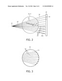 METAL ARTEFACT PREVENTION DURING NEEDLE GUIDANCE UNDER (XPER) CT diagram and image