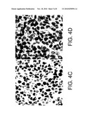 O-Methylated Rapamycin Derivatives For Alleviation And Inhibition Of Lymphoproliferative Disorders diagram and image