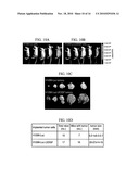 COMPOSITIONS AND METHODS FOR MODULATING VASCULAR ENDOTHELIAL GROWTH FACTOR C (VEGF-C) EXPRESSION diagram and image