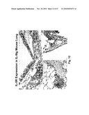 METHODS OF REDUCING EOSINOPHIL LEVELS diagram and image