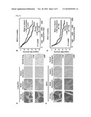 CANCER ASSOCIATED GENE LY6K diagram and image