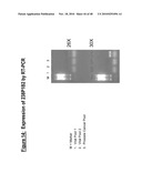 NUCLEIC ACID ENCODING 238P1B2 USEFUL IN DETECTING CANCER diagram and image