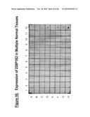 NUCLEIC ACID ENCODING 238P1B2 USEFUL IN DETECTING CANCER diagram and image