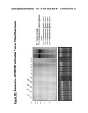 NUCLEIC ACID ENCODING 238P1B2 USEFUL IN DETECTING CANCER diagram and image