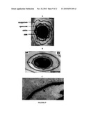 Compositions And Methods For Screening And Using Compounds Antagonizing Spore-Surface Interactions diagram and image