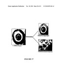 Compositions And Methods For Screening And Using Compounds Antagonizing Spore-Surface Interactions diagram and image