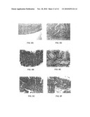 Extracellular serine protease diagram and image