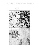 PROTEIN SHOWING ENHANCED EXPRESSION IN CANCER CELLS diagram and image