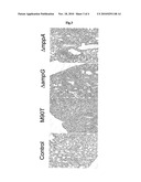 Shigella mutants in the functions pertaining to the processes of maturing and recycling peptidoglycans and their uses as immunogens diagram and image