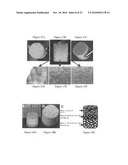 Multi-phased, biodegradable and osteointegrative composite scaffold for biological fixation of musculoskeletal soft tissue of bone diagram and image