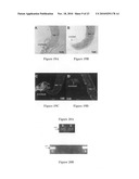 Multi-phased, biodegradable and osteointegrative composite scaffold for biological fixation of musculoskeletal soft tissue of bone diagram and image