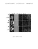 Periostin Inhibitory Compositions for Myocardial Regeneration, Methods of Delivery, and Methods of Using Same diagram and image