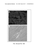 Periostin Inhibitory Compositions for Myocardial Regeneration, Methods of Delivery, and Methods of Using Same diagram and image