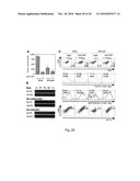 REDUCER OF IMMUNOSUPPRESSION BY TUMOR CELL AND ANTITUMOR AGENT USING THE SAME diagram and image