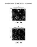 COMPOSITIONS AND METHODS FOR INHIBITING OR REVERSING FIBROTIC DISORDERS diagram and image