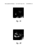 ANTI-ANGIOGENIC COMPOSITIONS AND METHODS OF USE diagram and image