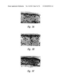 ANTI-ANGIOGENIC COMPOSITIONS AND METHODS OF USE diagram and image