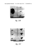 ANTI-ANGIOGENIC COMPOSITIONS AND METHODS OF USE diagram and image