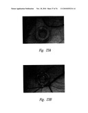 ANTI-ANGIOGENIC COMPOSITIONS AND METHODS OF USE diagram and image