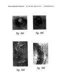 ANTI-ANGIOGENIC COMPOSITIONS AND METHODS OF USE diagram and image