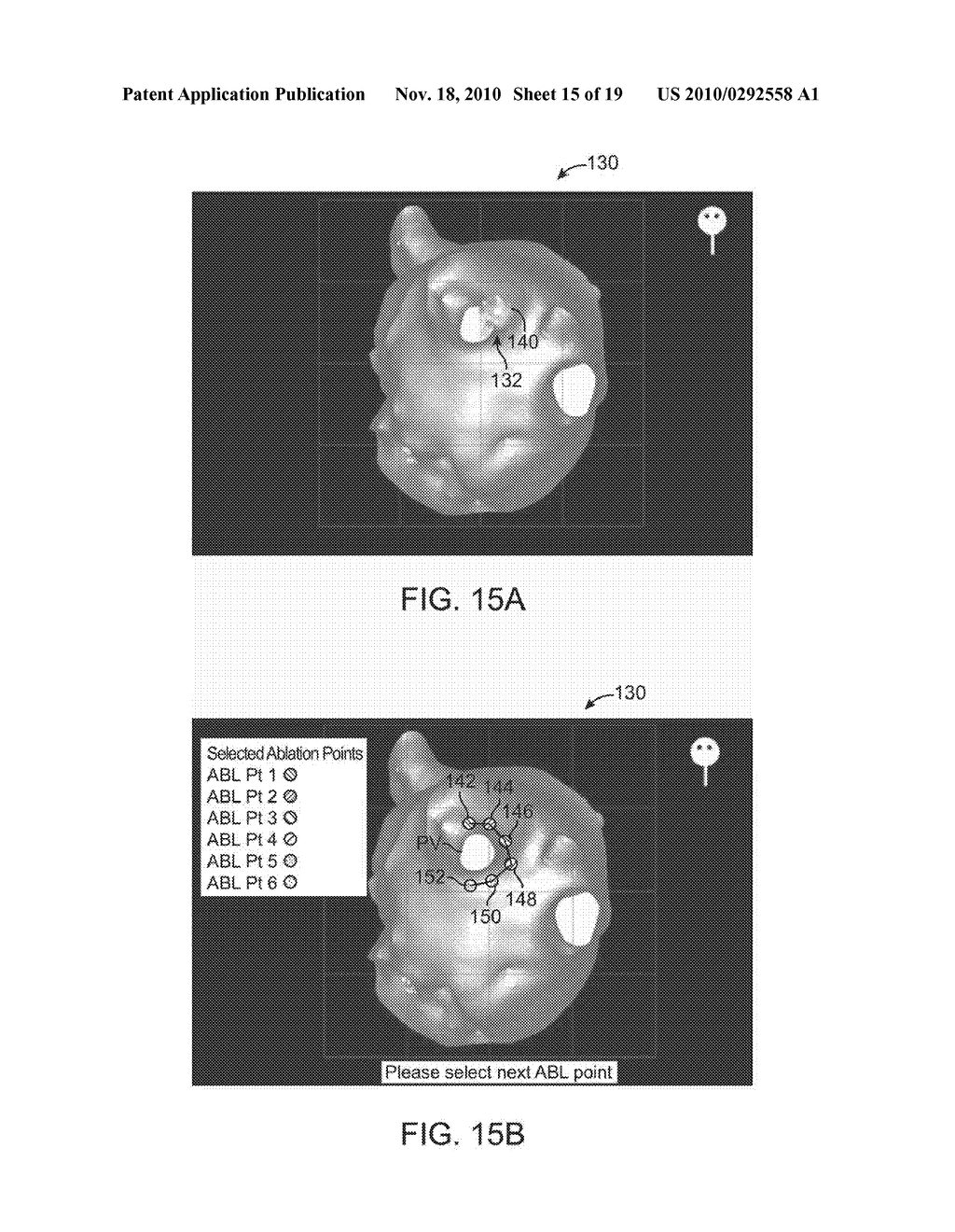 IN-VIVO VISUALIZATION SYSTEMS - diagram, schematic, and image 16