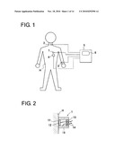 ARTERIOSCLEROSIS DIAGNOSTIC DEVICE diagram and image