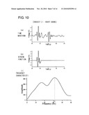 ARTERIOSCLEROSIS DIAGNOSTIC DEVICE diagram and image