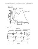 ARTERIOSCLEROSIS DIAGNOSTIC DEVICE diagram and image