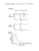 ARTERIOSCLEROSIS DIAGNOSTIC DEVICE diagram and image