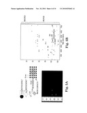 SEIZURE FORECASTING, MICROSEIZURE PRECURSOR EVENTS, AND RELATED THERAPEUTIC METHODS AND DEVICES diagram and image