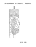 AIR SEPARATOR FOR EXTRACORPOREAL FLUID TREATMENT SETS diagram and image