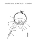 SYRINGE GUIDE AND SHIELD FOR USE IN ADMINISTERING OPHTHALMOLOGIC INJECTIONS diagram and image