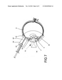 SYRINGE GUIDE AND SHIELD FOR USE IN ADMINISTERING OPHTHALMOLOGIC INJECTIONS diagram and image