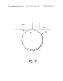 METHODS AND APPARATUS FOR FORMING CARDIAC LESIONS AND ASSESSING LESION QUALITY diagram and image