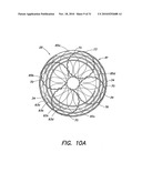 METHODS AND APPARATUS FOR FORMING CARDIAC LESIONS AND ASSESSING LESION QUALITY diagram and image