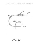 METHODS AND APPARATUS FOR FORMING CARDIAC LESIONS AND ASSESSING LESION QUALITY diagram and image