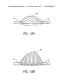 METHODS AND APPARATUS FOR FORMING CARDIAC LESIONS AND ASSESSING LESION QUALITY diagram and image