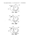 METHODS AND APPARATUS FOR FORMING CARDIAC LESIONS AND ASSESSING LESION QUALITY diagram and image