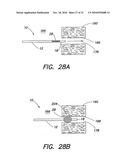 METHODS AND APPARATUS FOR FORMING CARDIAC LESIONS AND ASSESSING LESION QUALITY diagram and image