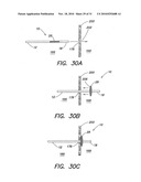 METHODS AND APPARATUS FOR FORMING CARDIAC LESIONS AND ASSESSING LESION QUALITY diagram and image