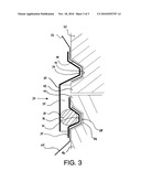 Sterile Barrier For A Surgical Robot With Torque Sensors diagram and image