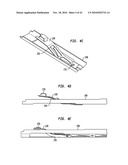 SURGICAL FASTENERS, APPLICATOR INSTRUMENTS, AND METHODS FOR DEPLOYING SURGICAL FASTENERS diagram and image