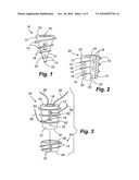 BIOELECTRIC IMPLANT AND METHOD diagram and image