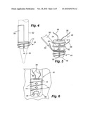 BIOELECTRIC IMPLANT AND METHOD diagram and image