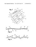 BIOELECTRIC IMPLANT AND METHOD diagram and image