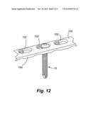 BIOELECTRIC IMPLANT AND METHOD diagram and image