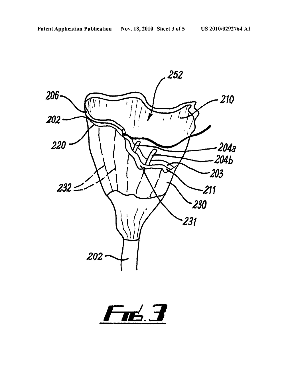 LAPAROSCOPIC KIDNEY COOLING SHEATH - diagram, schematic, and image 04